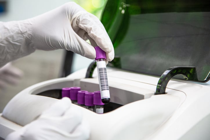 barcode labeling printing scanning for blood samples